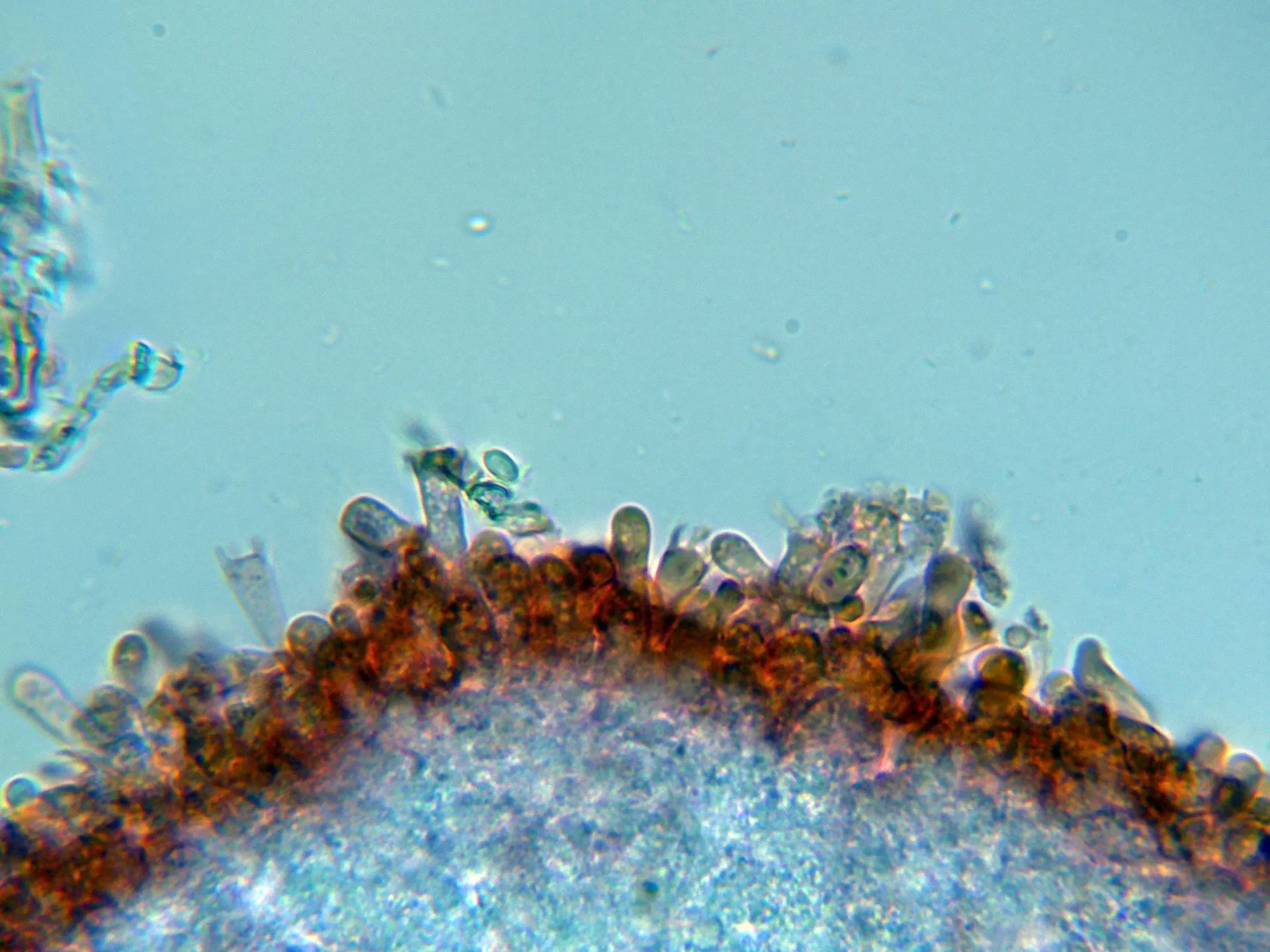 Microscopía de Sistotrema octosporum - 10 - Basidios fusionado